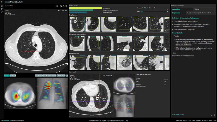 Providing-an-Efficient-3D-Image-Based-Search-Engine-for-Radiology-Workflows