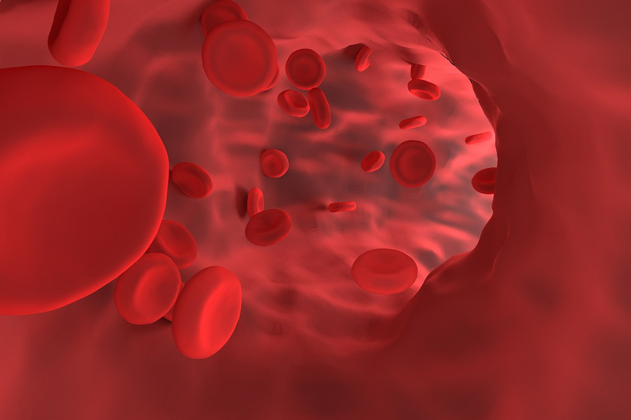hemoglobin-heart-failure-patients