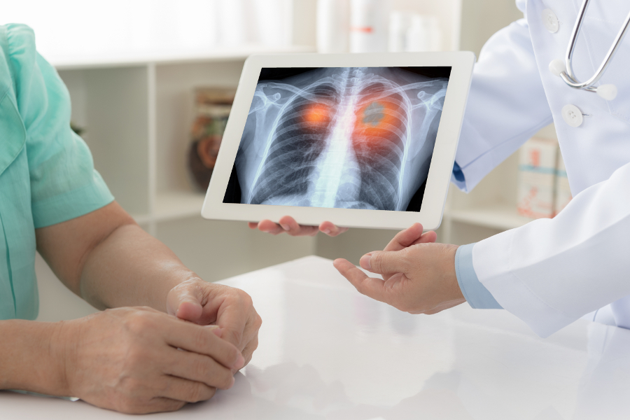 Improving-the-healthcare-continuum-of-lung-cancer-patients